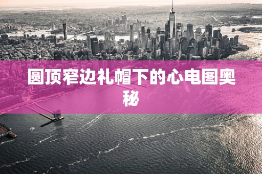 圆顶窄边礼帽下的心电图奥秘